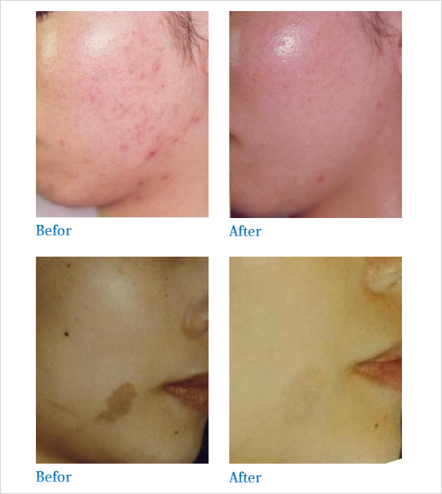 BeforeAfter